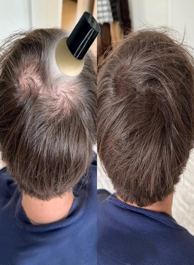 KERATIN RESEARCH Hairline Filler Unisex Mineral Powder Root Touch-Up Hair loss Concealer Scalp & Beard Bald Patch Coverage Fibers for Thinning Hair Waterproof Organic Natural look (MEDIUM BROWN, XL) - Image 3